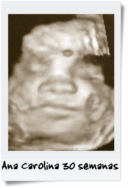 ultrasonido-bebé